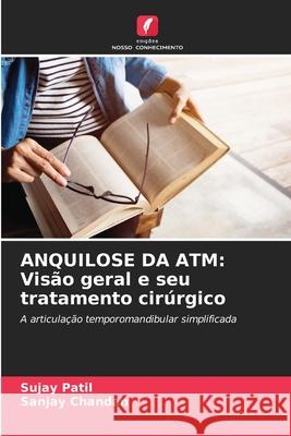 Anquilose Da ATM: Vis?o geral e seu tratamento cir?rgico Sujay Patil Sanjay Chandan 9786207667284 Edicoes Nosso Conhecimento - książka