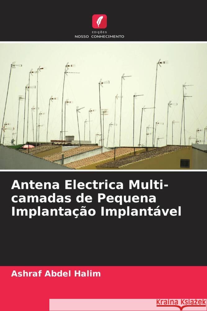 Antena Electrica Multi-camadas de Pequena Implantação Implantável Abdel Halim, Ashraf 9786204825656 Edições Nosso Conhecimento - książka