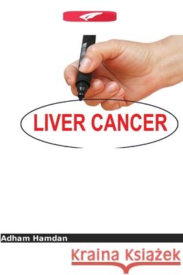 Antenas implantadas no fígado Hamdan, Adham 9786136432090 Edições Nosso Conhecimento - książka