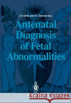 Antenatal Diagnosis of Fetal Abnormalities James O. Drife Dian Donnai 9781447118565 Springer - książka