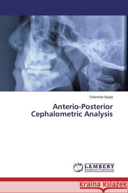 Anterio-Posterior Cephalometric Analysis Gupta, Chanchal 9786135826340 LAP Lambert Academic Publishing - książka