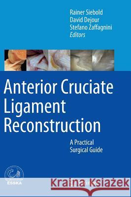 Anterior Cruciate Ligament Reconstruction: A Practical Surgical Guide Siebold, Rainer 9783642453489 Springer - książka