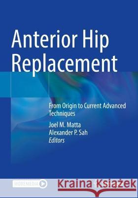 Anterior Hip Replacement  9783030918989 Springer International Publishing - książka