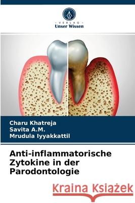 Anti-inflammatorische Zytokine in der Parodontologie Charu Khatreja, Savita A M, Mrudula Iyyakkattil 9786203358919 Verlag Unser Wissen - książka