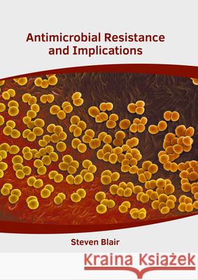 Antimicrobial Resistance and Implications Steven Blair 9781639272082 American Medical Publishers - książka