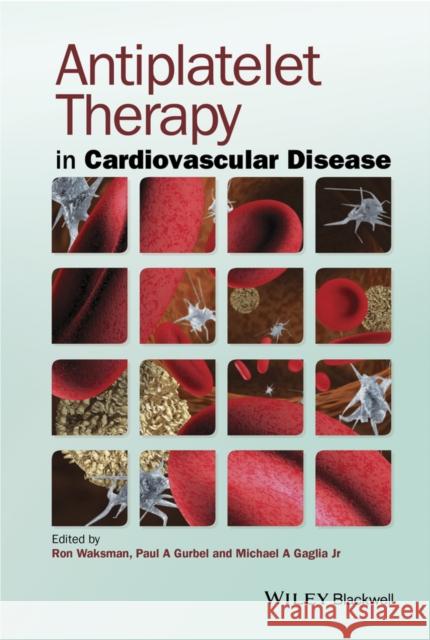 Antiplatelet Therapy in Cardiovascular Disease Waksman, Ron 9781118275757 John Wiley & Sons - książka