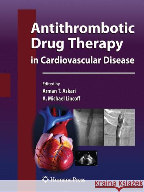 Antithrombotic Drug Therapy in Cardiovascular Disease Arman T. Askari 9781603272346 Humana Press - książka