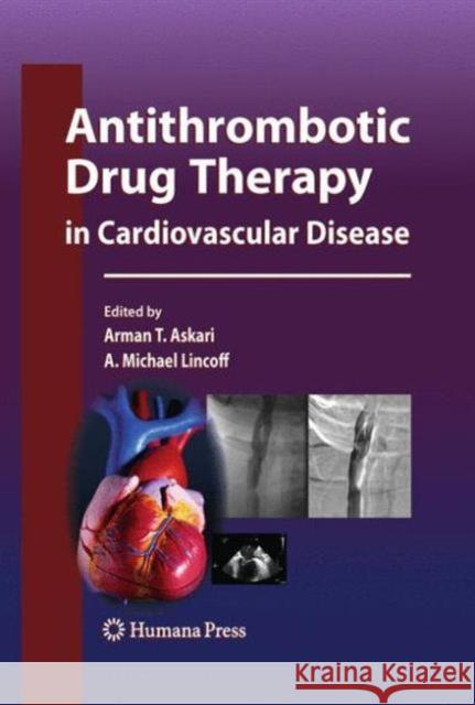 Antithrombotic Drug Therapy in Cardiovascular Disease Arman T Askari, MD A Michael Lincoff  9781627037976 Humana Press - książka