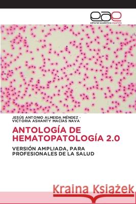 ANTOLOGÍA DE HEMATOPATOLOGÍA 2.0 ALMEIDA MENDEZ, JESUS ANTONIO, Macias Nava, Victoria Ashanty 9786208826741 Editorial Académica Española - książka