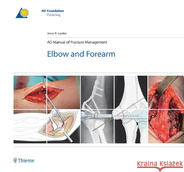 Ao Manual of Fracture Management - Elbow & Forearm Jupiter, Jesse 9783131492715 Thieme Medical Publishers - książka