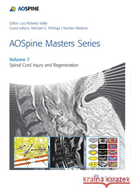 Aospine Masters Series, Volume 7: Spinal Cord Injury and Regeneration Vialle, Luiz Roberto Gomes 9781626232273 Thieme Medical Publishers - książka