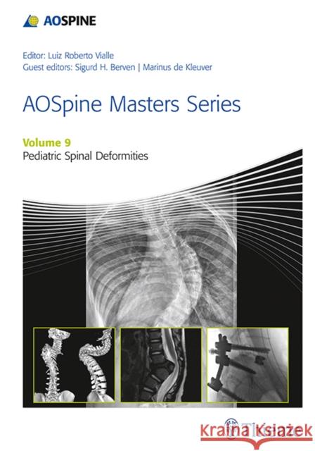 Aospine Masters Series, Volume 9: Pediatric Spinal Deformities de Kleuver, Marinus 9781626234536 Thieme Medical Publishers - książka