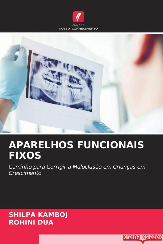 APARELHOS FUNCIONAIS FIXOS Kamboj, Shilpa, Dua, Rohini 9786204638768 Edições Nosso Conhecimento - książka