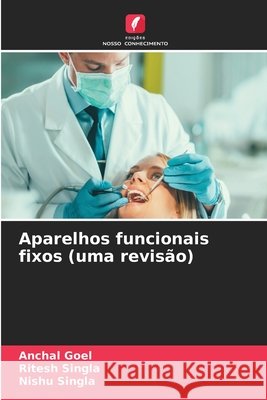 Aparelhos funcionais fixos (uma revis?o) Anchal Goel Ritesh Singla Nishu Singla 9786630183900 Edicoes Nosso Conhecimento - książka