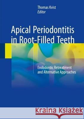 Apical Periodontitis in Root-Filled Teeth: Endodontic Retreatment and Alternative Approaches Kvist, Thomas 9783319572482 Springer - książka