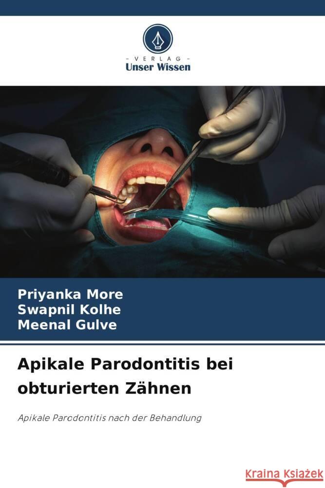 Apikale Parodontitis bei obturierten Z?hnen Priyanka More Swapnil Kolhe Meenal Gulve 9786208047177 Verlag Unser Wissen - książka