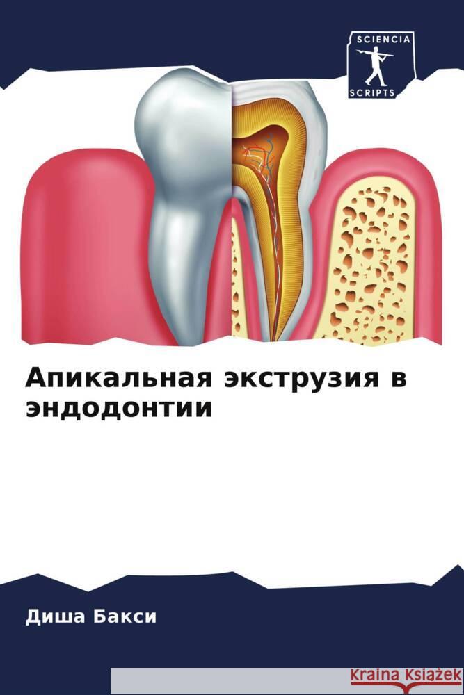 Apikal'naq äxtruziq w ändodontii Baxi, Disha 9786204677828 Sciencia Scripts - książka