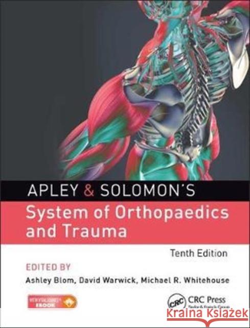 Apley & Solomon's System of Orthopaedics and Trauma Blom, Ashley 9781498751674 Taylor & Francis Inc - książka