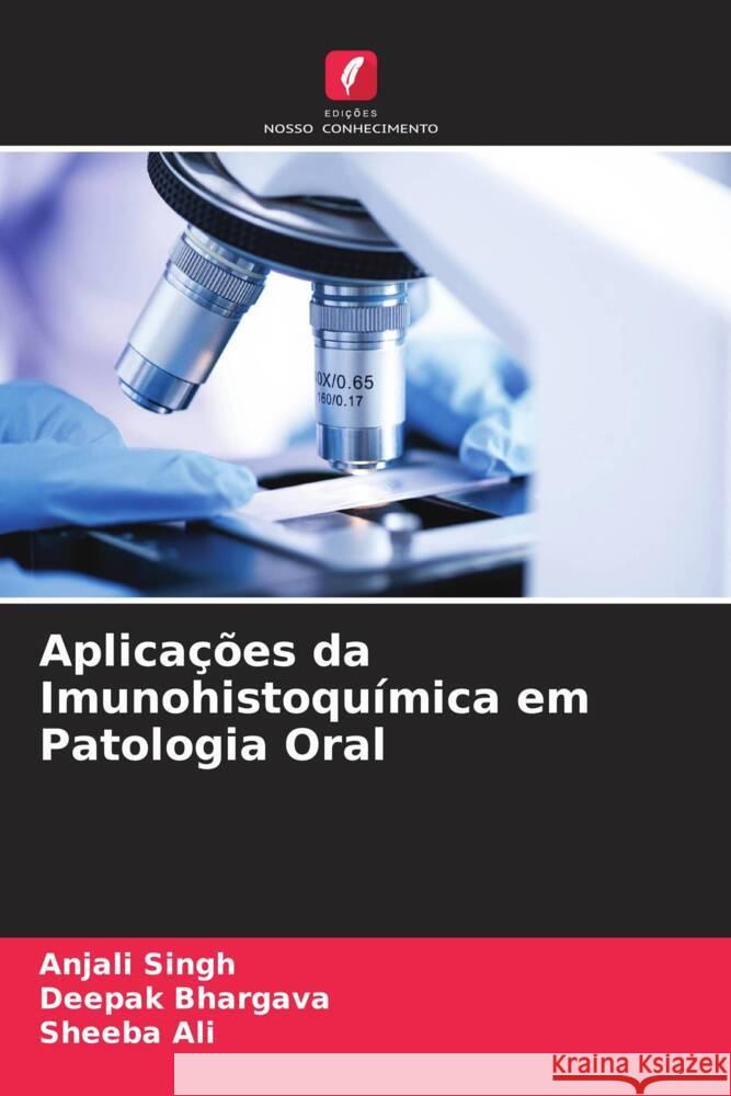 Aplicações da Imunohistoquímica em Patologia Oral Singh, Anjali, Bhargava, Deepak, Ali, Sheeba 9786204760094 Edições Nosso Conhecimento - książka