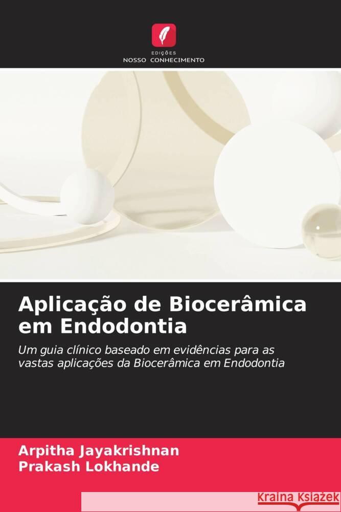 Aplica??o de Biocer?mica em Endodontia Arpitha Jayakrishnan Prakash Lokhande 9786206867548 Edicoes Nosso Conhecimento - książka