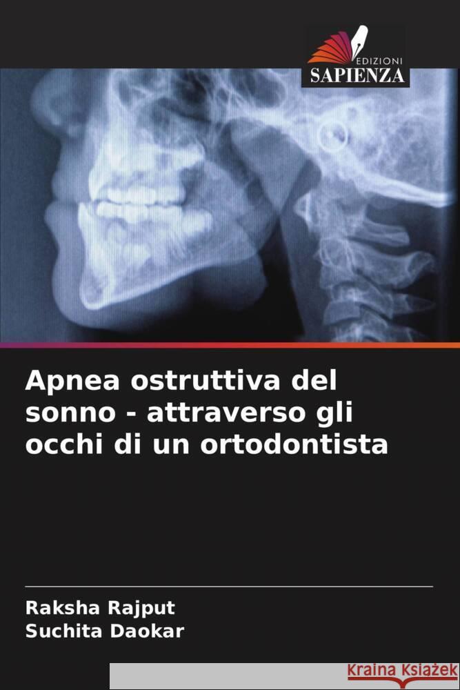 Apnea ostruttiva del sonno - attraverso gli occhi di un ortodontista Rajput, Raksha, Daokar, Suchita 9786204646275 Edizioni Sapienza - książka