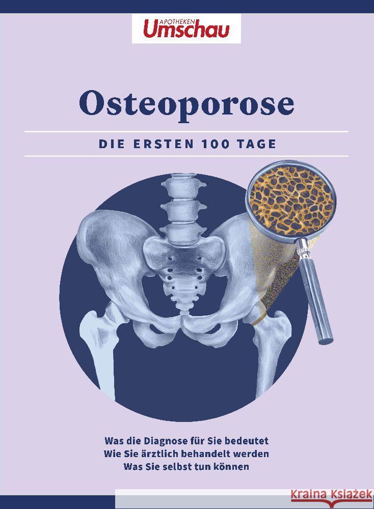 Apotheken Umschau: Osteoporose  9783927216693 Wort & Bild Verlag - książka