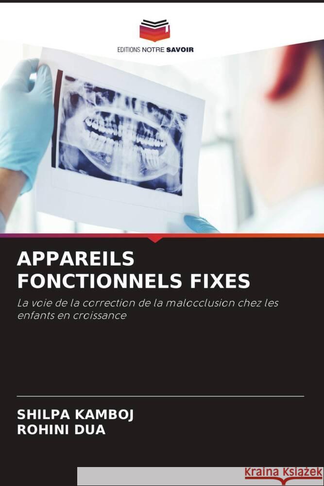 APPAREILS FONCTIONNELS FIXES Kamboj, Shilpa, Dua, Rohini 9786204638744 Editions Notre Savoir - książka