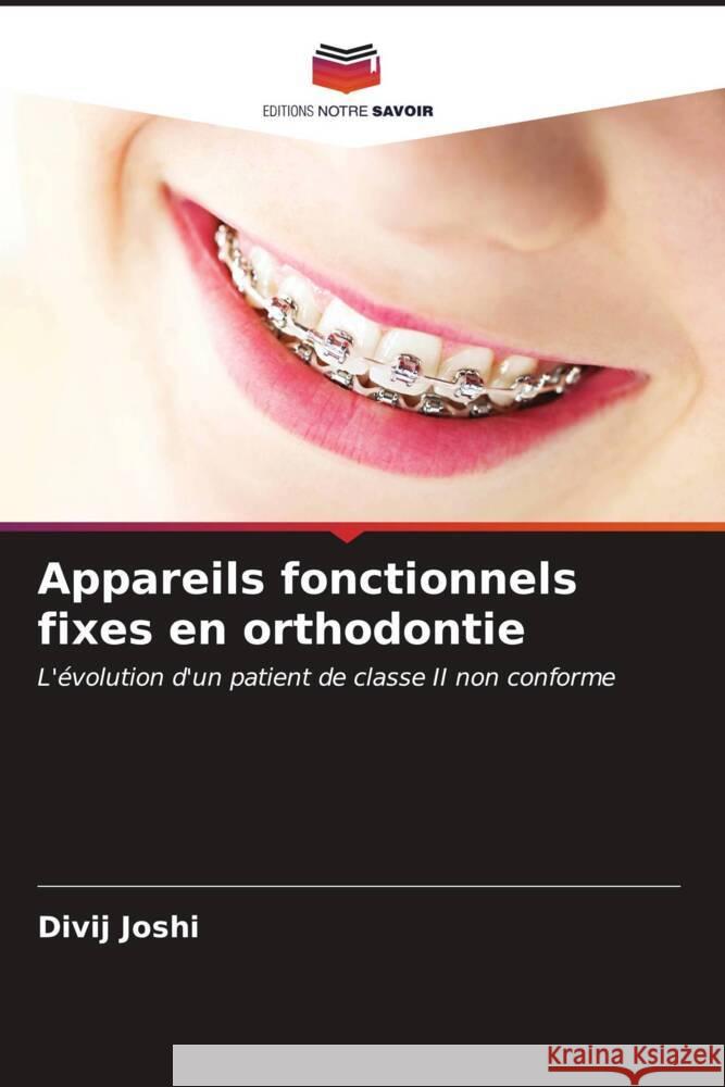 Appareils fonctionnels fixes en orthodontie Joshi, Divij 9786206608745 Editions Notre Savoir - książka