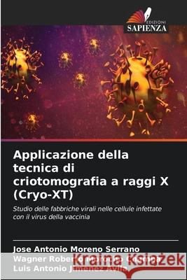 Applicazione della tecnica di criotomografia a raggi X (Cryo-XT) Jose Antonio Moren Wagner Roberto Moroch Luis Antonio Jimene 9786207701254 Edizioni Sapienza - książka