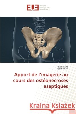 Apport de l'imagerie au cours des ost?on?croses aseptiques Faten Frikha Yosr Hentati 9786208976941 Editions Universitaires Europeennes - książka