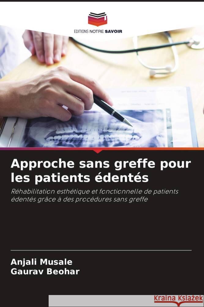Approche sans greffe pour les patients édentés Musale, Anjali, Beohar, Gaurav 9786208570880 Editions Notre Savoir - książka