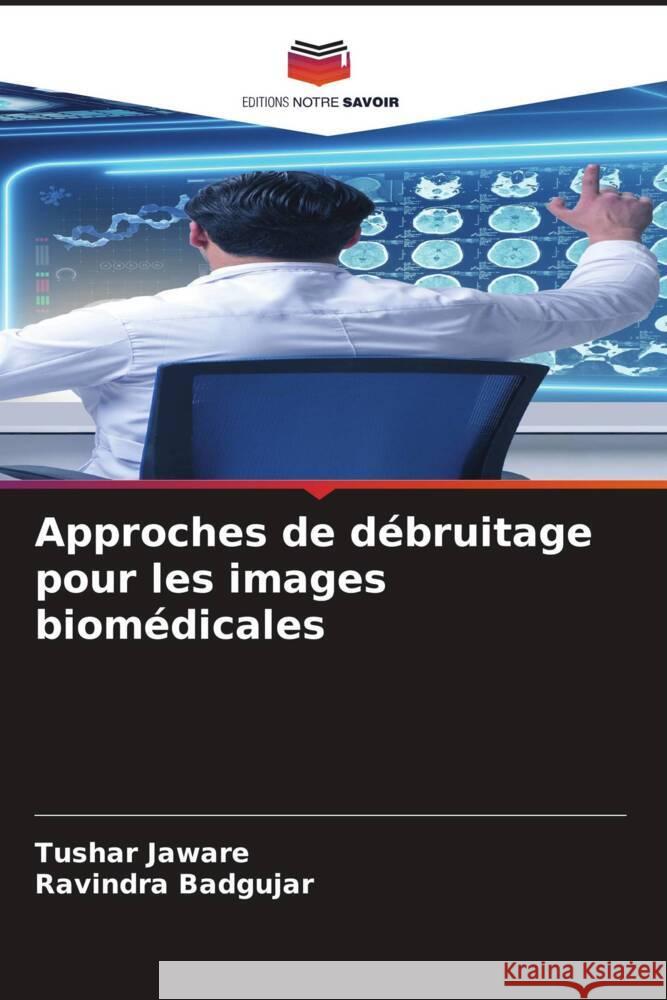 Approches de débruitage pour les images biomédicales Jaware, Tushar, Badgujar, Ravindra 9786204762326 Editions Notre Savoir - książka