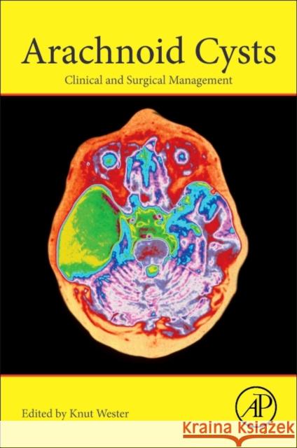 Arachnoid Cysts: Clinical and Surgical Management Knut Wester 9780128143780 Academic Press - książka