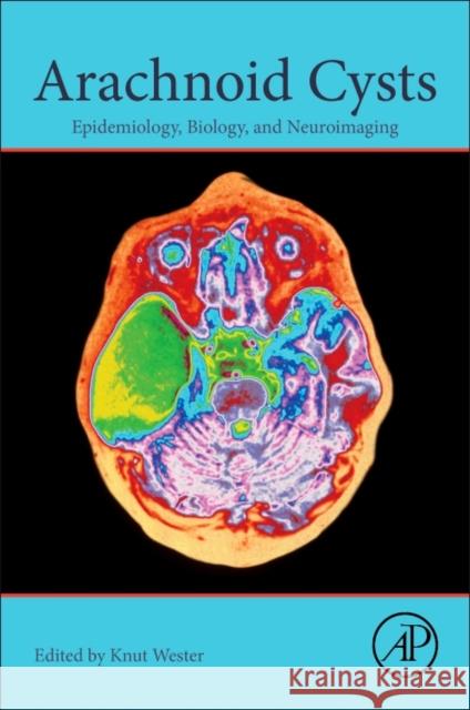 Arachnoid Cysts: Epidemiology, Biology, and Neuroimaging Knut Wester Helland A. Christian Guy D. Eslick 9780128099322 Academic Press - książka