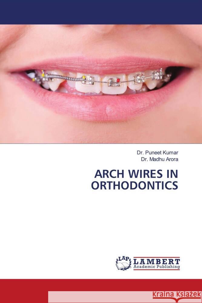 ARCH WIRES IN ORTHODONTICS Kumar, Dr. Puneet, Arora, Dr. Madhu 9786208171704 LAP Lambert Academic Publishing - książka