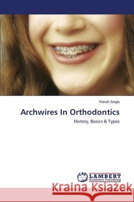 Archwires In Orthodontics Singla Ritesh 9783659673306 LAP Lambert Academic Publishing - książka