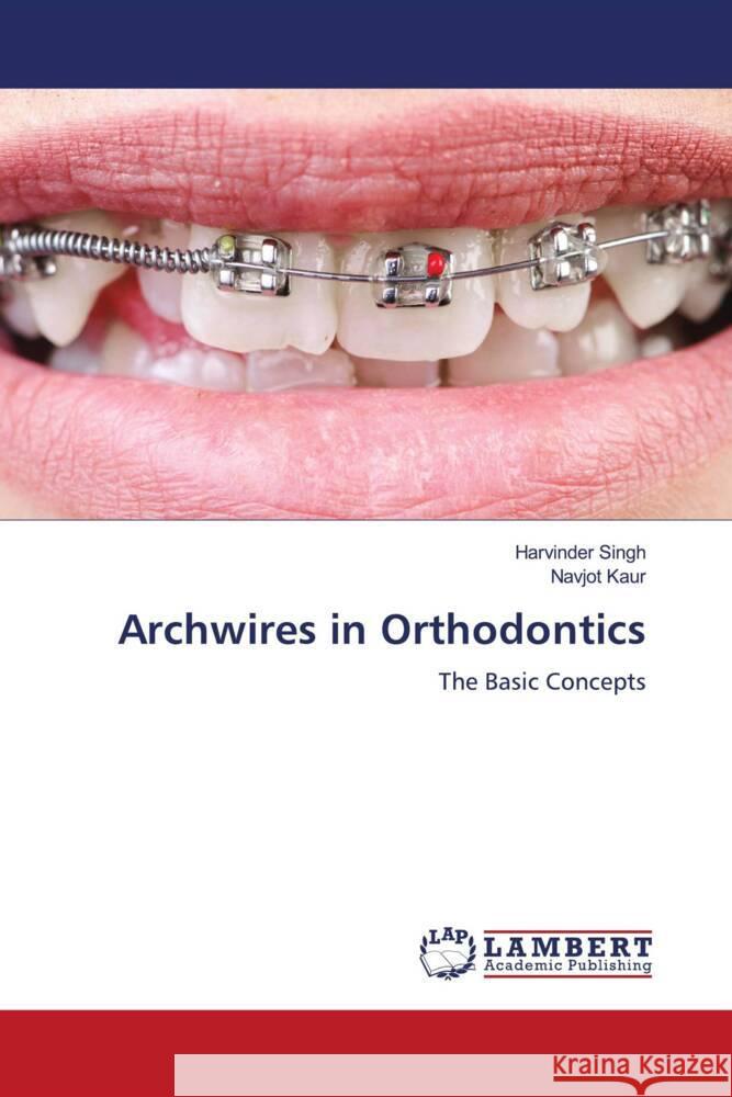 Archwires in Orthodontics Singh, Harvinder, Kaur, Navjot 9786205495353 LAP Lambert Academic Publishing - książka