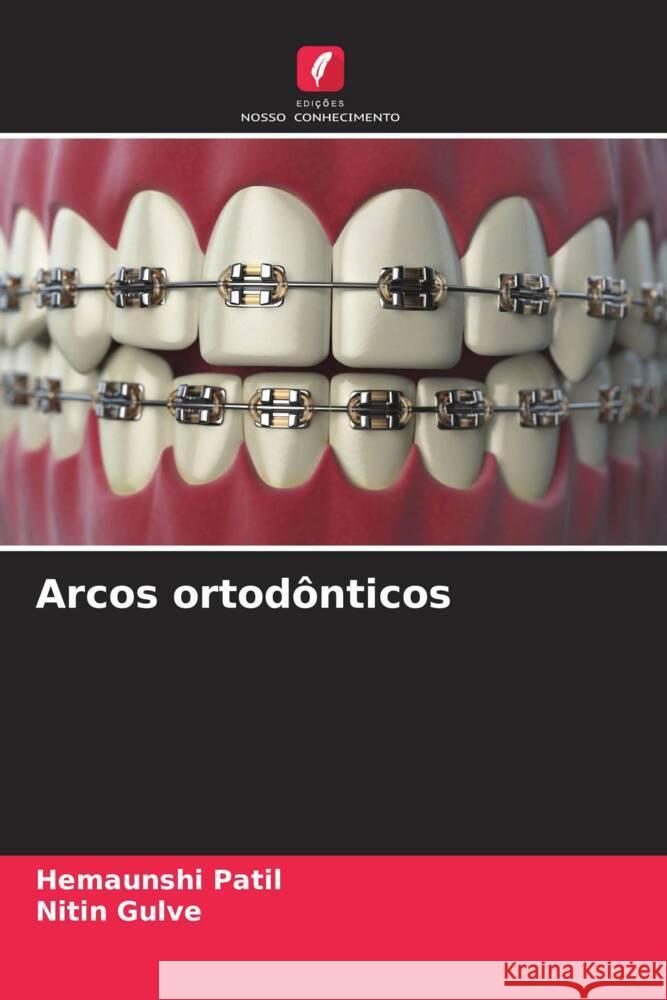 Arcos ortod?nticos Hemaunshi Patil Nitin Gulve 9786208228644 Edicoes Nosso Conhecimento - książka