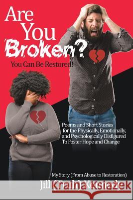 Are You Broken? You Can Be Restored! Jill (Truh) Kennedy 9781545650684 Xulon Press - książka