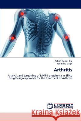 Arthritis Ashish Kumar Rai, Rohit Raj Singh 9783659107962 LAP Lambert Academic Publishing - książka
