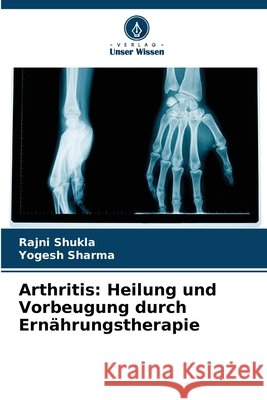 Arthritis: Heilung und Vorbeugung durch Ernährungstherapie Shukla, Rajni, Sharma, Yogesh 9786209771002 Verlag Unser Wissen - książka