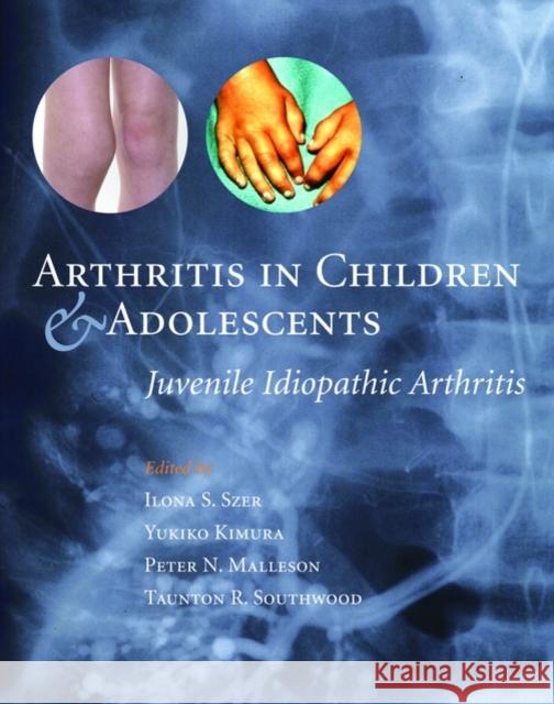 Arthritis in Children and Adolescents : Juvenile Idiopathic Arthritis Ilona S. Szer Yukiko Kimura Peter N. Malleson 9780192632920 Oxford University Press - książka