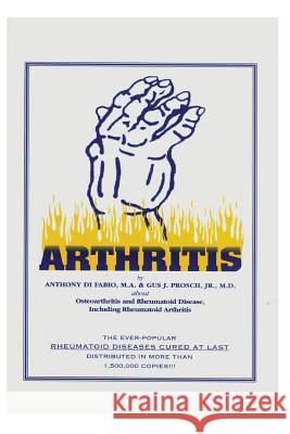 Arthritis: Osteoarthritis and Rheumatoid Disease Including Rheumatoid Arthritis Gus J. Prosc Anthony D 9781514303719 Createspace - książka