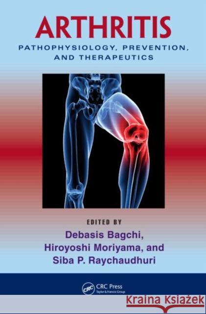 Arthritis: Pathophysiology, Prevention, and Therapeutics Bagchi, Debasis 9781439816868 CRC Press - książka