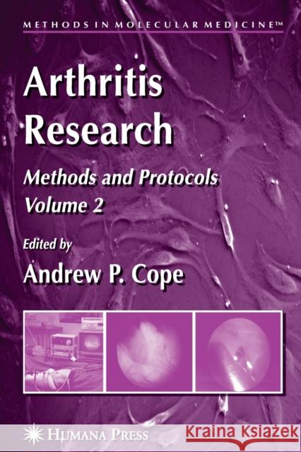 Arthritis Research: Volume 2: Methods and Protocols Cope, Andrew P. 9781617378454 Springer - książka