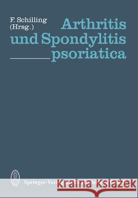 Arthritis Und Spondylitis Psoriatica F. Schilling 9783798506756 Not Avail - książka