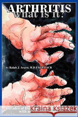 Arthritis what is it?: Decades of Diagnosis and Management with an exciting future Argen Facp, Ralph J. 9780595313037 iUniverse - książka