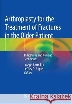 Arthroplasty for the Treatment of Fractures in the Older Patient: Indications and Current Techniques Borrelli Jr, Joseph 9783030068127 Springer - książka