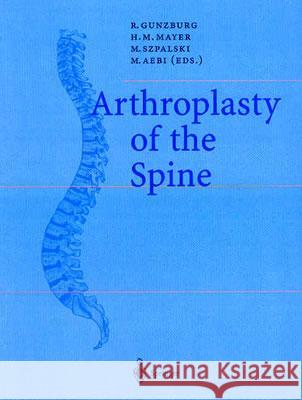 Arthroplasty of the Spine R. Gunzburg H. M. Mayer M. Szpalski 9783540202950 Springer - książka