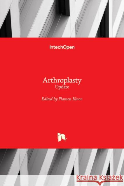 Arthroplasty: Update Plamen Kinov 9789535109952 Intechopen - książka